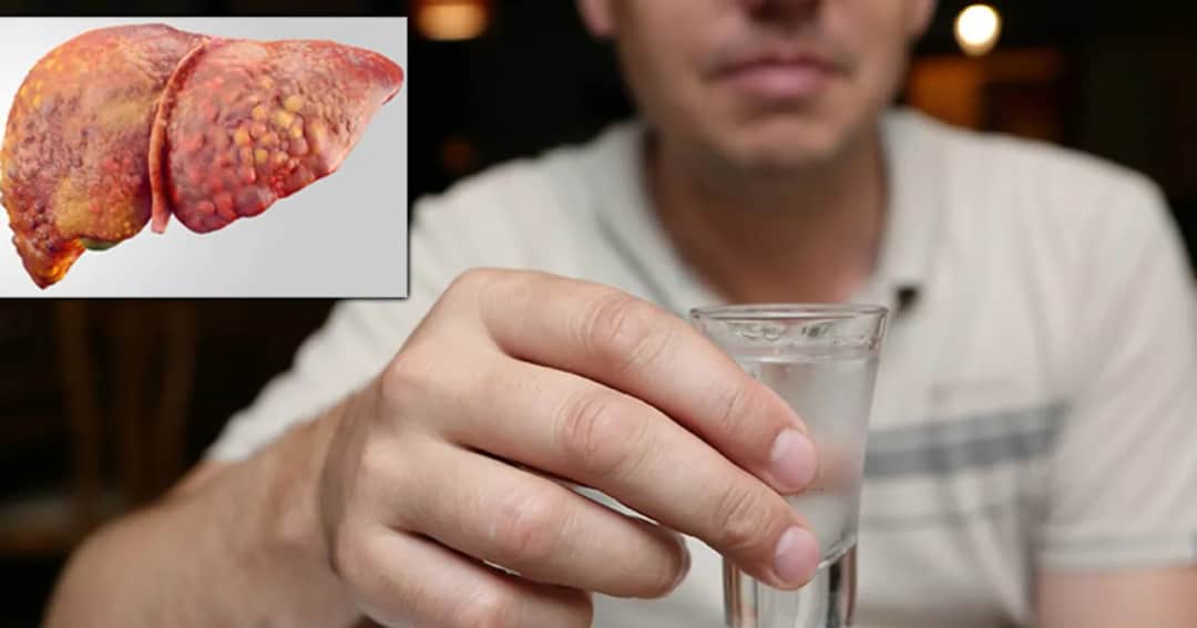 Jakie leki na wątrobę po alkoholu mogą uratować Twoje zdrowie?