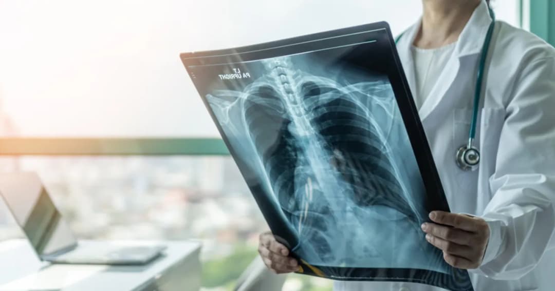 Czy wynaleziono lek na raka? Oto najnowsze przełomy w leczeniu