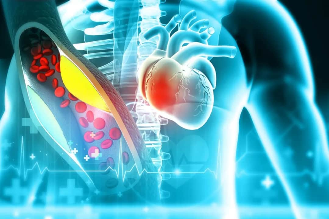 Czy leki na cholesterol szkodzą? Poznaj skutki uboczne i ryzyko